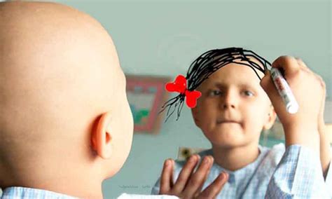 leucemia en niños